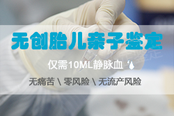 石家庄怀孕亲子鉴定机构出结果要多久,石家庄孕期亲子鉴定流程 石家庄怀孕亲子鉴定机构出结果要多久,石家庄孕期亲子鉴定流程