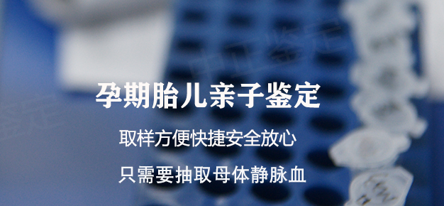 石家庄怀孕十二周如何做无创产前亲子鉴定,石家庄做无创产前亲子鉴定办理费用 石家庄怀孕十二周如何做无创产前亲子鉴定,石家庄做无创产前亲子鉴定办理费用